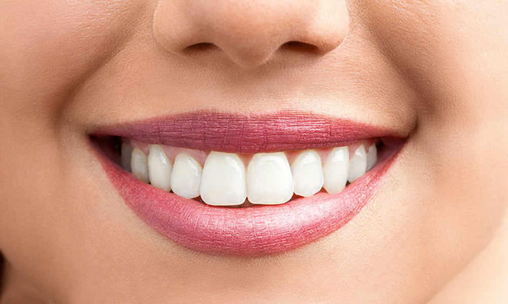 teeth whitening strips after