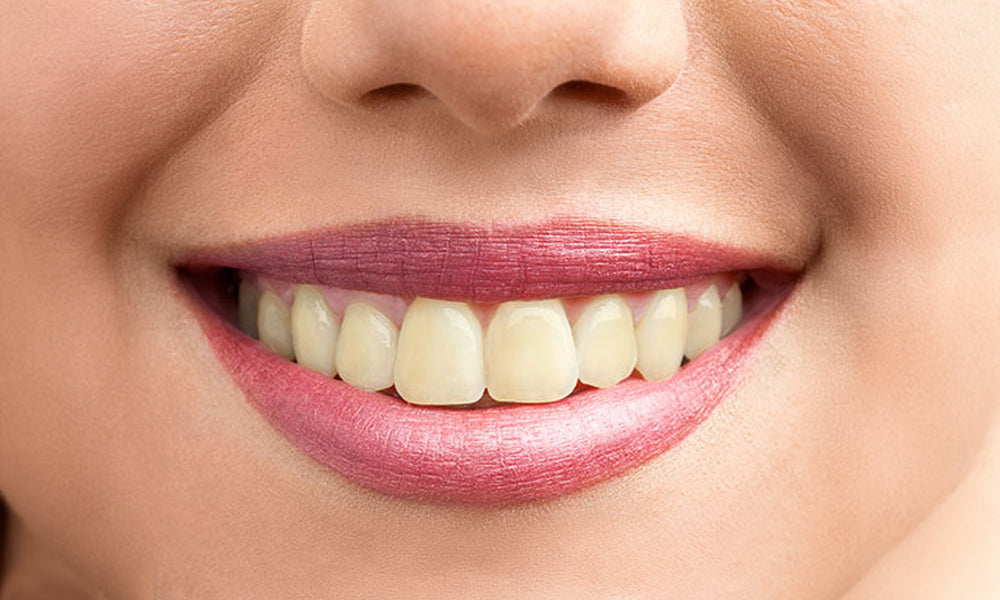 teeth whitening strips before