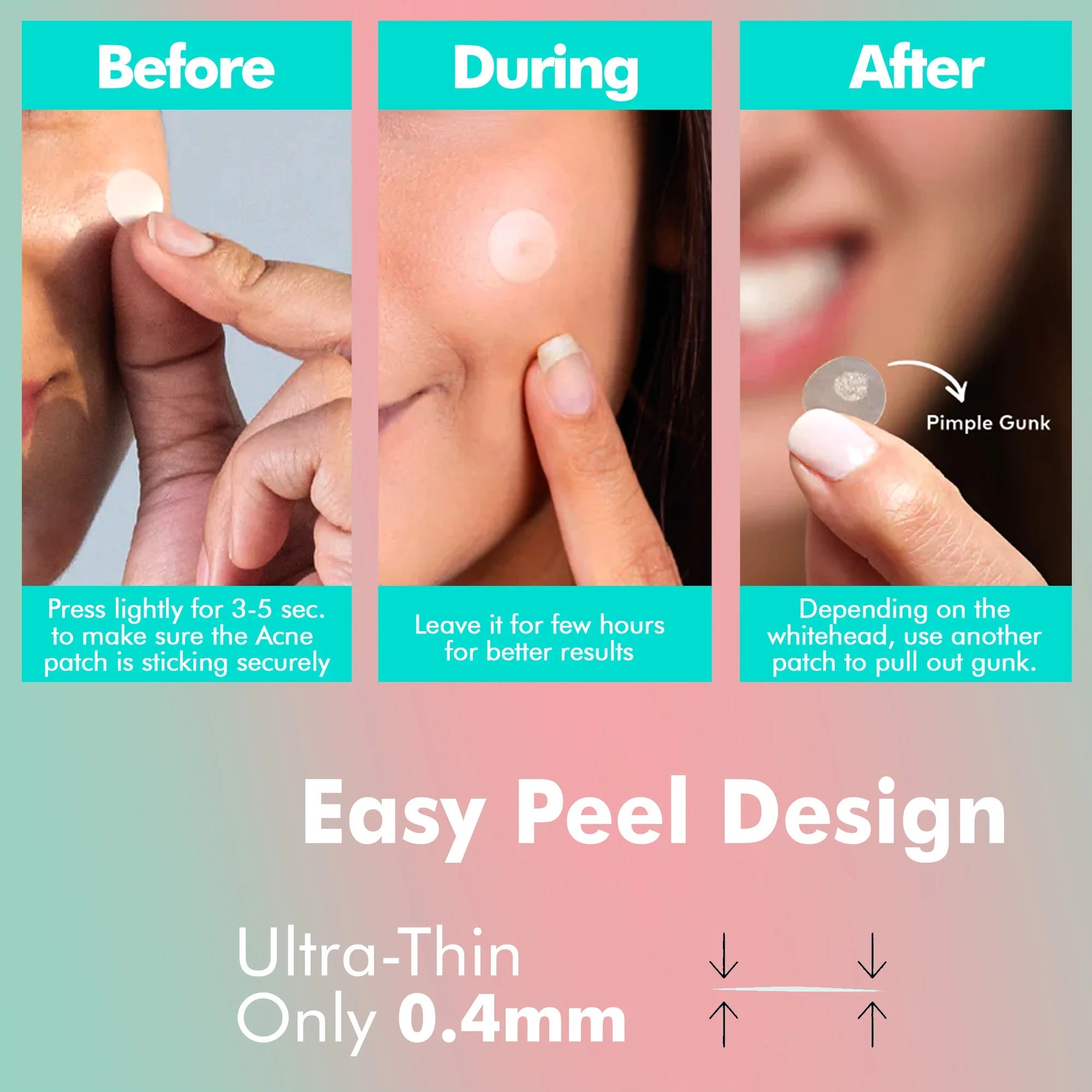 Acne Patch (Hydrocolloid) - MasterMedi